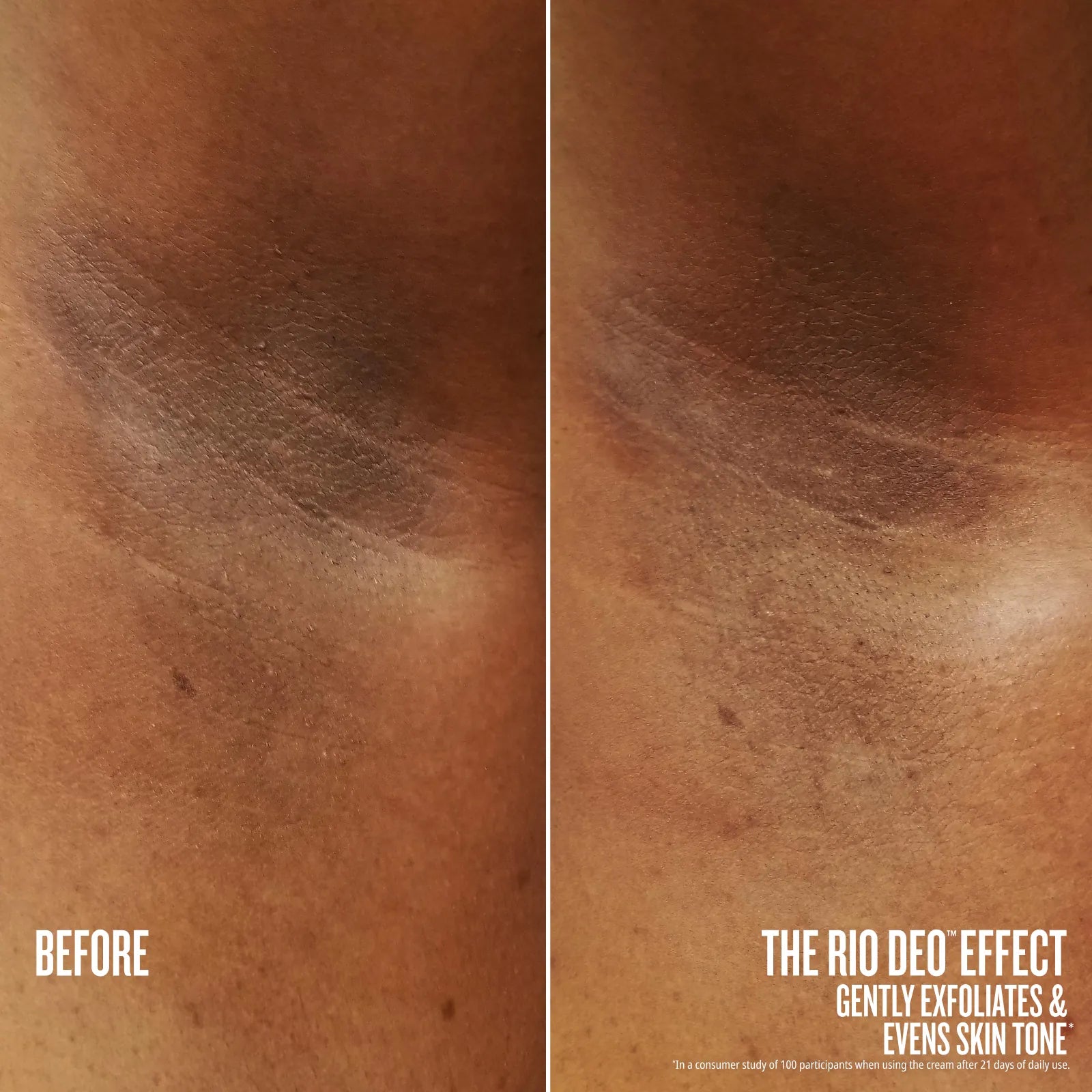 Before and after comparison of skin exfoliation with text indicating product effect.